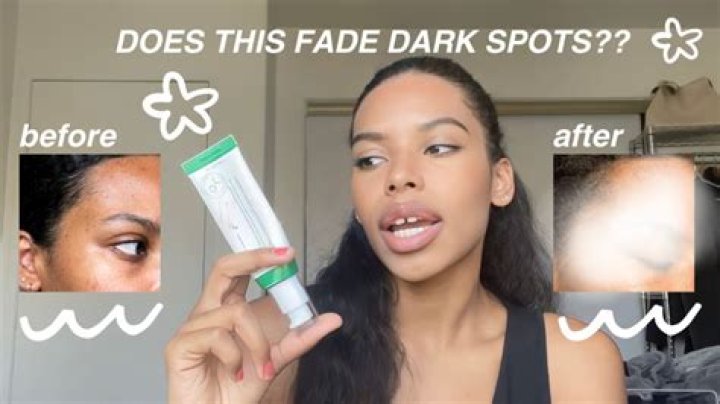 Discover The Power Of Organic Dark Spot Serum Reviews