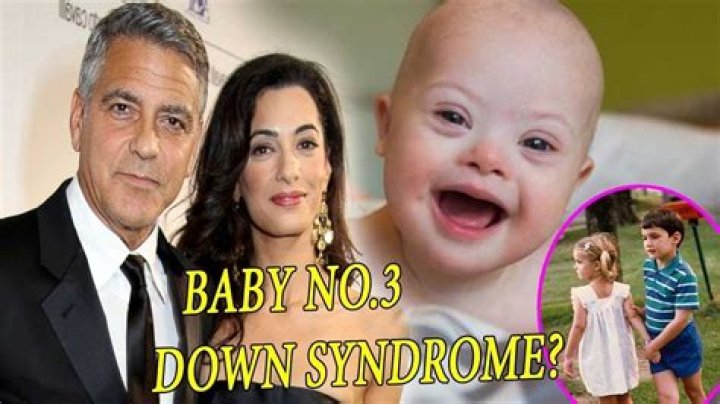 George Clooney's Son And Down Syndrome