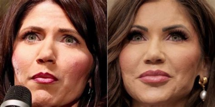 Uncover The Enigma Of Kristi Noem's Cosmetic Surgery