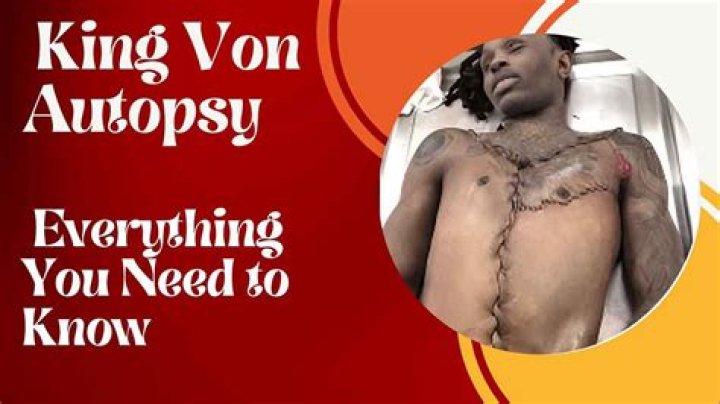 Unveiling King Von's Autopsy: Unraveling The Mystery