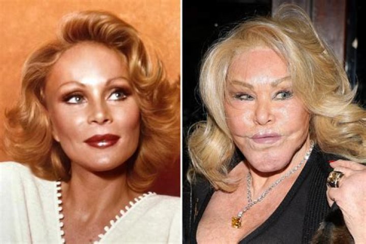 Unveiling The Secrets Of Catwoman's Plastic Surgery: Discoveries And Insights